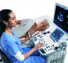 cardiac ultrasound, ASE, American society of echo