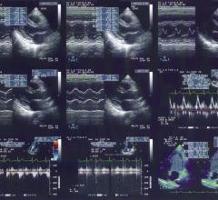 ContextVision, VEPiO, personalized image optimization, ultrasound, RSNA 2015