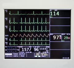 Cedars-Sinai Team Develops New Sudden Cardiac Arrest Risk Assessment Score