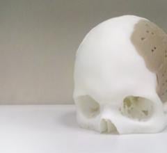 3-D printing, advanced visualization, Yale-OPM joint research program