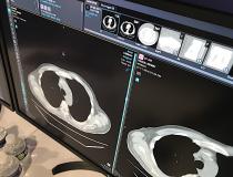 A radiology workflow improvement shown by several vendors at HIMSS, including this image from Change Healthcare. The system offers a thumbnail manu at the top of a current exam to automatically create new views of the data set with one click. #HIMSS #Radiology #radiologyworkflow #HIMSS21