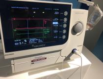 The Abiomed Impella control console. 