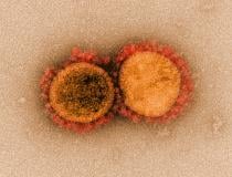 A National Institutes of Health (NIH) image of two coronaviruses (COVID-19) from high-powered microscopy. 