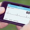 AliveCor Practice Fusion ECG remote wireless electronic medical record patient