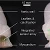 Researchers 3-D Print Lifelike Heart Valve Models with embedded sensor technology 