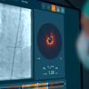 Abbott recently announced its new interventional imaging platform powered by Ultreon 1.0 Software, has gained European CE marked. This first-of-its-kind imaging software merges optical coherence tomography (OCT) intravascular imaging with the power of artificial intelligence (AI) for enhanced visualization. The new Ultreon Software can automatically detect the severity of calcium-based blockages and measure vessel diameter to enhance the precision of physicians’ decision-making during coronary stenting proc