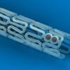 FDA Investigating Increased Major Adverse Cardiac Event Rates of Absorb Bioresorbable Stent