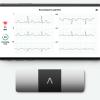 FDA Clears AliveCor's KardiaMobile 6L as First Six-Lead Personal ECG Device