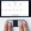 Alivecor's pocket ECG system allows consumers or cardiologists to record a single lead ECG. AI algorithms can determine if their ECG is normal or abnormal and identify the arrhythmia. 