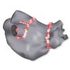 FDA Approves Biosense Webster's Tag-Index Guided Ablation Software