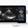 The FDA granted marketing authorization of the Caption Guidance software to Caption Health Inc. in February 2020. It uses artificial intelligence to guide users to get optimal cardiac ultrasound images in a point of care ultrasound (POCUS) setting.