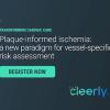 ischemia, plaque, ai