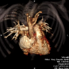 Cardiac CT image 3D reconstruction of the heart