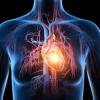 Heart attack, statins, 