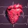 cardiac output, algorithm, 