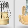 The LivaNova Percelval sutureless aortic valve and Solo Smart surgical aortic valve are part of heart valve portfolio the company sold off June 1 to Gyrus Capital and Corcym..