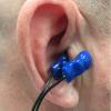 The Parasym Salustim device ear clip stimulates the vagus nerve, which was found to reduced AF burden compared with a sham procedure in the TREAT AF trial. 