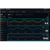 Retia Medical cardiovascular software