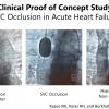 Novel Therapeutic Approach Effective at Reducing Pressure for Heart Failure Patients