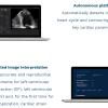 EchoGo uses AI to calculate cardiac ultrasound left ventricular ejection fraction (EF), the most frequently used measurement of heart function, left ventricular volumes (LV) and, for the first time for an AI application, automated cardiac strain.