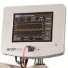 FFR-Search Registry Reveals Impact of Post-PCI Fraction Flow Reserve Measurement on Outcomes