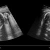 ContextVision, US PLUSView ultrasound enhancement software, iOS