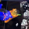 Imricor Completes Enrollment for Clinical Study on Vision-MR Ablation Catheter 