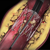 Intact Vascular, TOBA clinical study, one-year results, Tack Endovascular System, Journal of Vascular Surgery