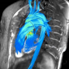 Arterys collaborated with GE Healthcare to create the ViosWorks software to cardiac MRI analysis.