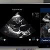 The artificial intelligence-driven Caption Guidance software guides point of care ultrasound (POCUS) users to get optimal cardiac ultrasound images. The AI software is an example of a FDA-cleared software that is helping improve imaging, even when used by less experienced users.
