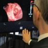 EchoPixel showed technology at TCT 2019 that creates live holograms in the cath lab from 3-D TEE imaging. It projects the holograms on a special display screen that does not require the user to wear 3-D glasses. The interventional cardiologist can use hand movements and a foot switch to move the image around without breaking the sterile field. It offers a new way to visualize catheters, device positioning and deployment for structural heart procedures. #TCT2019 #TCT #TCT19