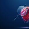 IVUS, cardiac imaging