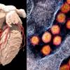 COVID-19 has a big impact on the heart, and patients with pre-existing cardiovascular disease have at least a 10 percent higher risk of death and severe complications due to the virus. The virus also can cause myocarditis, blood clotting, and impact the cardiovascular system due to severe, hyperactive inflammatory responses.  Left, a cardiac CT scan 3-D rendering. right, the COVID-19 virus from a National Institutes of Health (NIH) photo.