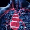 angiography, PCI, FFRangio