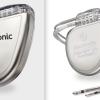 Medtronic is recalling some of its implantable cardioverter defibrillators (ICD) and cardiac resynchronization therapy (CRT-D) devices because of an unexpected and rapid decrease in battery life. The company said this is due to a short circuit and will cause some devices to produce a “Recommended Replacement Time” (first warning that the battery is low) earlier than expected. Some devices may progress from “Recommended Replacement Time” to full battery depletion within as little as one day.