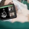 The Philips Lumify point-of-care ultrasound (POCUS) system uses an app and a transducer to convert a smartphone into a portable ultrasound system. Philips and GE Healthcare both offer small hand-held systems and are now facing increased competition from new POCUS vendors like Butterfly Network. 