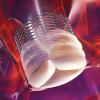 The Boston Scientific Lotus TAVR Valve