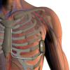 ICD Implants Heart Rhythm Society Clinical Study Insurance Male