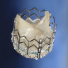 Edwards Sapien Valve Partner Clinical Trial Heart Valve Repair