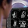 Philips, SmartHeart, cardiac MRI