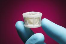 DISCOVER Clinical Trial Direct Medical Trial Direct Flow Medical Transcatheter 