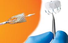 FDA US device innovation