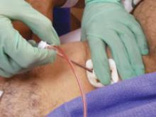 The implementation of dedicated access site surveillance and educational program