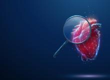 IVUS, cardiac imaging