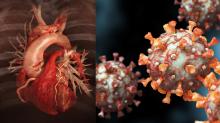 Top stories on COVID-19 related to cardiology in 2021.