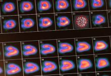 American Society of Nuclear Cardiology (ASNC) offers 5 Strategies for Improving Your Nuclear Cardiology Lab in 2021