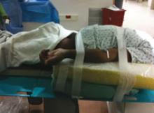 Radial access, arm board, 