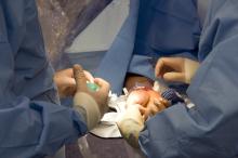 cath lab radial access SCAI