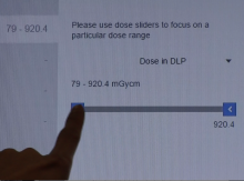 Siemens Teamplay radiation dose monitoring software