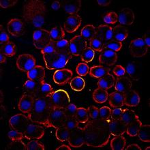 NeoStem, PreSERVE study, AMI, ACC.15, NBS10, CD34 stem cells